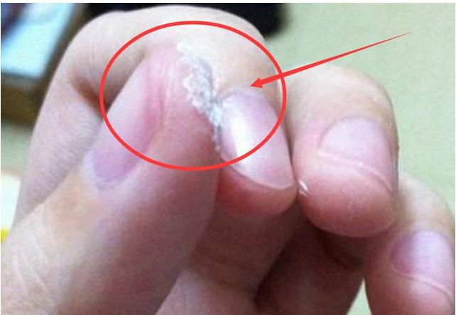 502膠水把手黏住了怎么辦