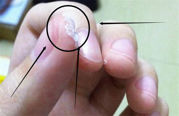  502膠水把手黏住了怎么辦